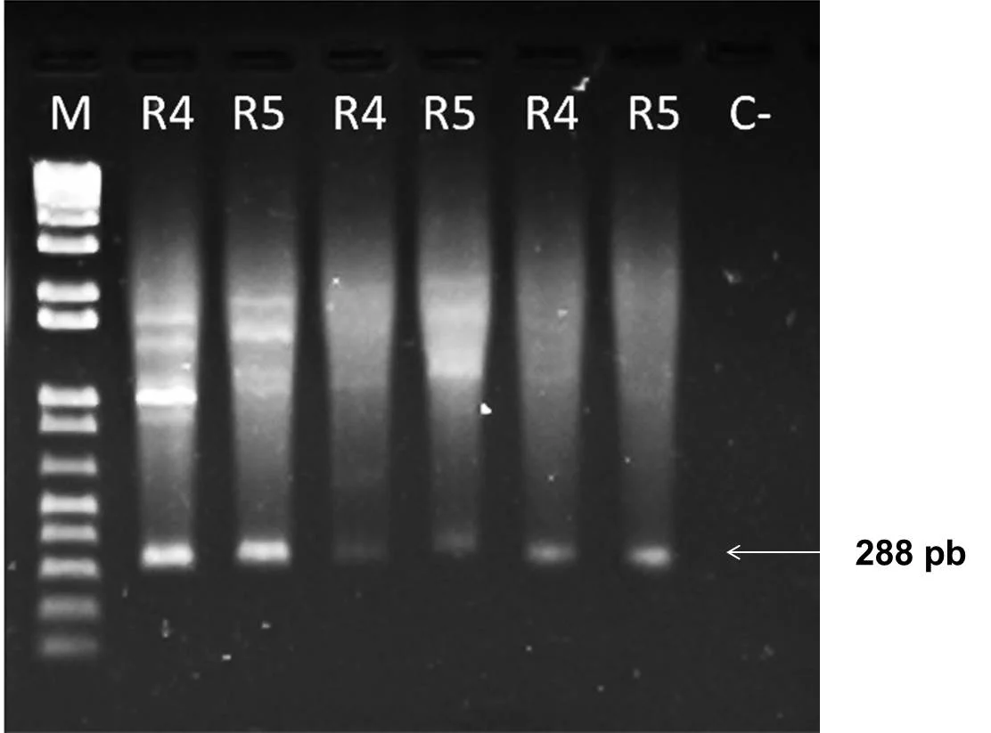 Amplificación del ARNr 16S con los cebadores OLI1 y Y2 en gel de agarosa al 1,5%